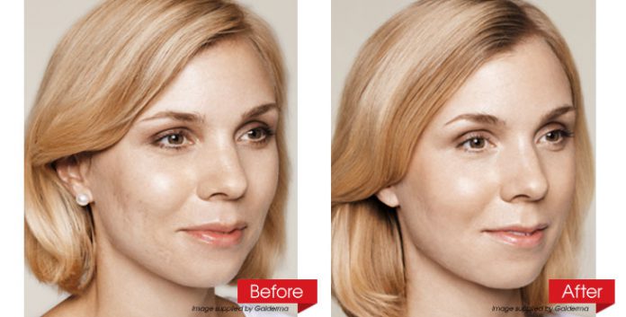 face-before-after-revised-2